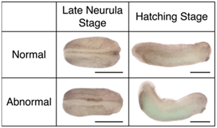 Tissue Rotation of the <i>Xenopus</i> Anterior-Posterior Neural Axis Reveals Profound but Transient Plasticity at the Mid-Gastrula Stage.