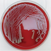 <i>Staphylococcus lugdunensis</i> in children: A retrospective analysis.