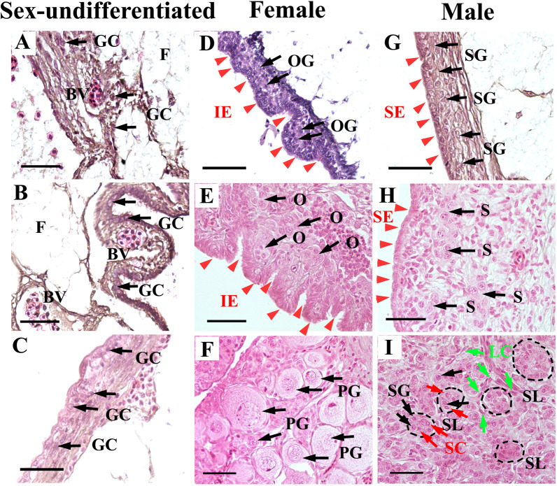 MiR-34b/c play a role in early sex differentiation of Amur sturgeon, Acipenser schrenckii.