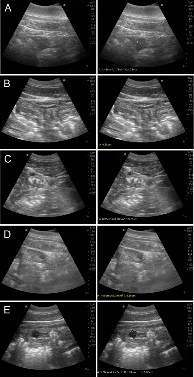 Follicular and Hormonal Changes after Estrous Synchronization in Bottlenose Dolphins.