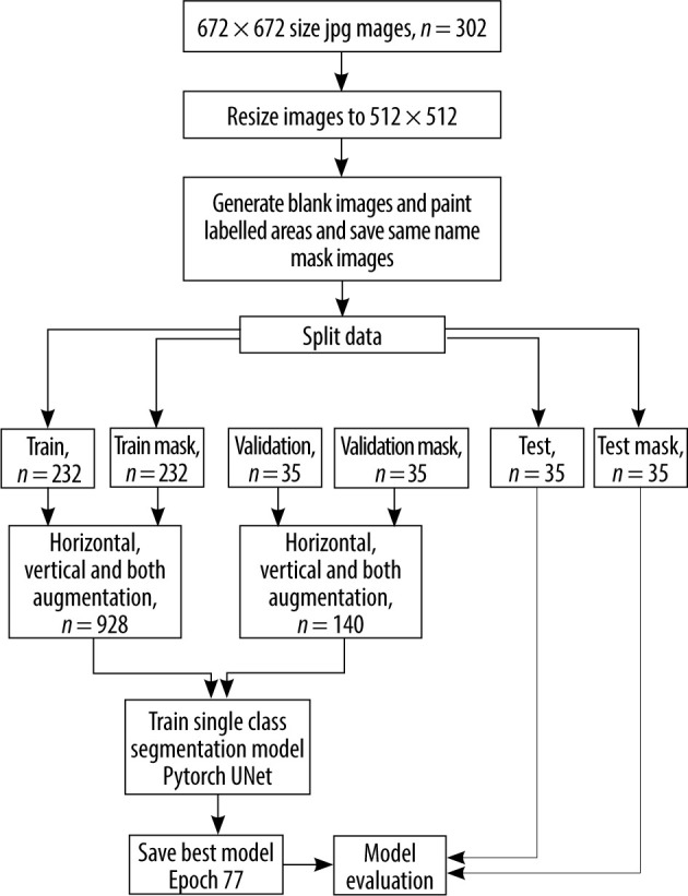 Segmentation of orbital and periorbital lesions detected in orbital magnetic resonance imaging by deep learning method.