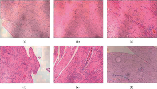 Syndecan-4 is More Sensitive in Detecting Hypertensive Left Ventricular Diastolic Dysfunction in 2K2C Rats.