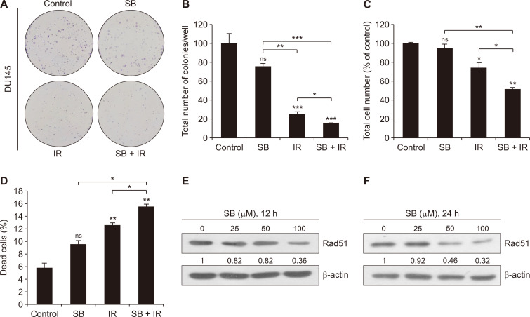 Silibinin Radiosensitizes EGF Receptor-knockdown Prostate Cancer Cells by Attenuating DNA Repair Pathways.