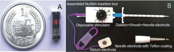 Treatment of stress urinary incontinence with a percutaneously implantable wireless microstimulator device (NuStim<sup>®</sup>) plus pelvic floor muscle exercises: a pilot study.