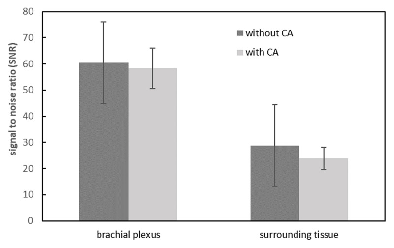 The Application of Contrast-Enhanced 3D-STIR-VISTA MR Imaging of the Brachial Plexus.