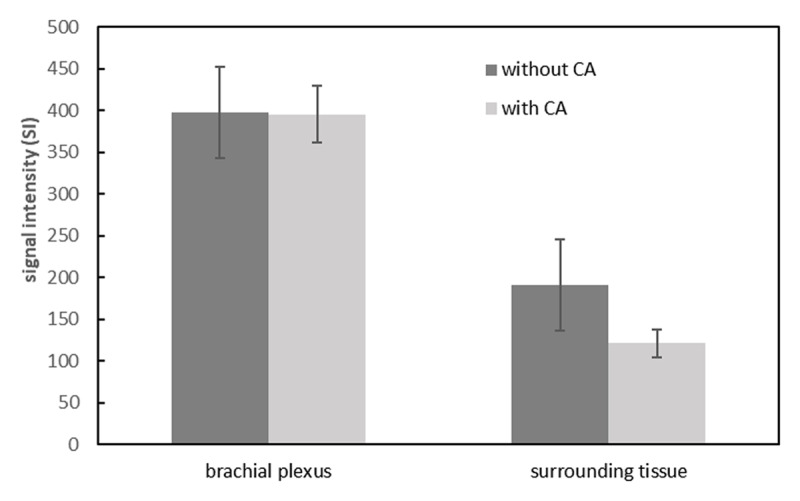 The Application of Contrast-Enhanced 3D-STIR-VISTA MR Imaging of the Brachial Plexus.