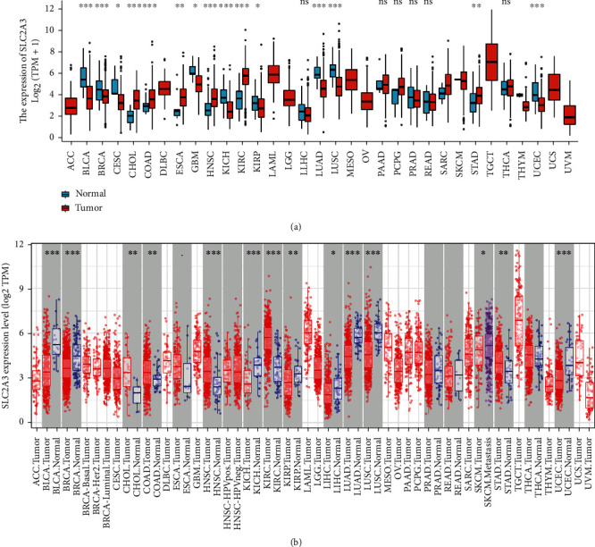 Comprehensive Analysis of the Role of <i>SLC2A3</i> on Prognosis and Immune Infiltration in Head and Neck Squamous Cell Carcinoma.