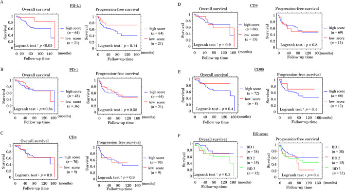 A combination of stromal PD-L1 and tumoral nuclear β-catenin expression as an indicator of colorectal carcinoma progression and resistance to chemoradiotherapy in locally advanced rectal carcinoma.