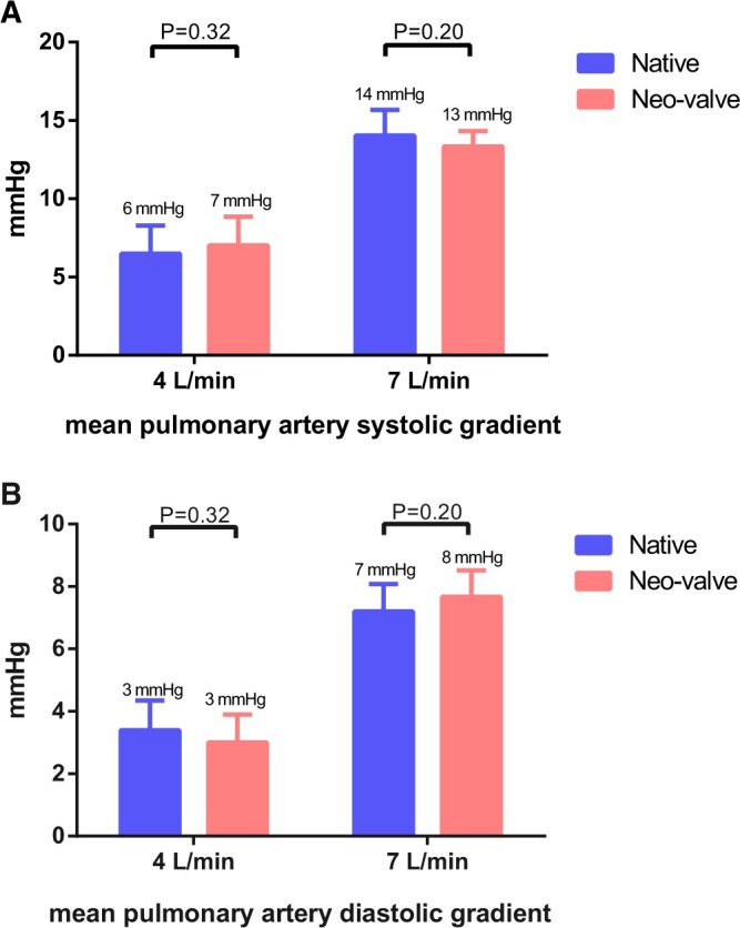 Trileaflet semilunar valve reconstruction: pulsatile in vitro evaluation.