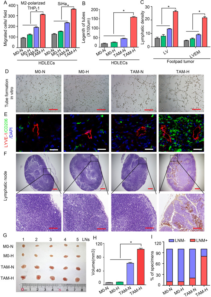 Correction: A novel lymphatic pattern promotes metastasis of cervical cancer in a hypoxic tumour-associated macrophage-dependent manner