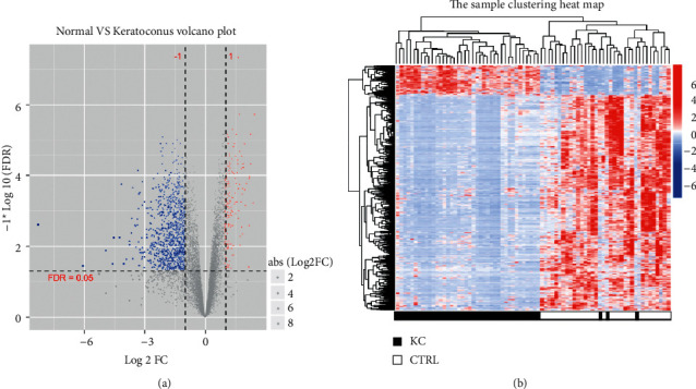 Identification of Important Genes of Keratoconus and Construction of the Diagnostic Model.