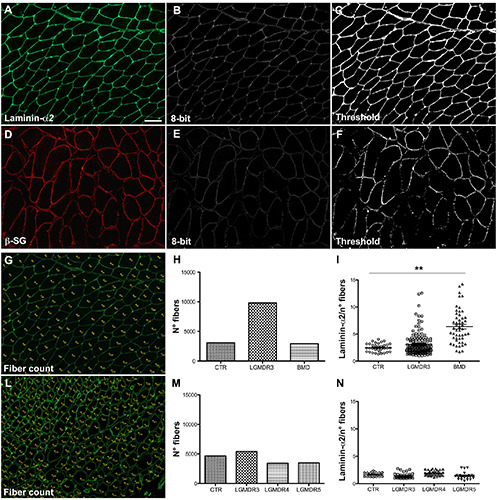 Immunofluorescence signal intensity measurements as a semi-quantitative tool to assess sarcoglycan complex expression in muscle biopsy.