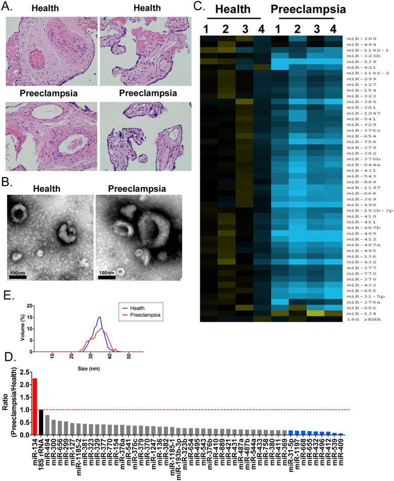 miR-31-5p from placental and peripheral blood exosomes is a potential biomarker to diagnose preeclampsia.