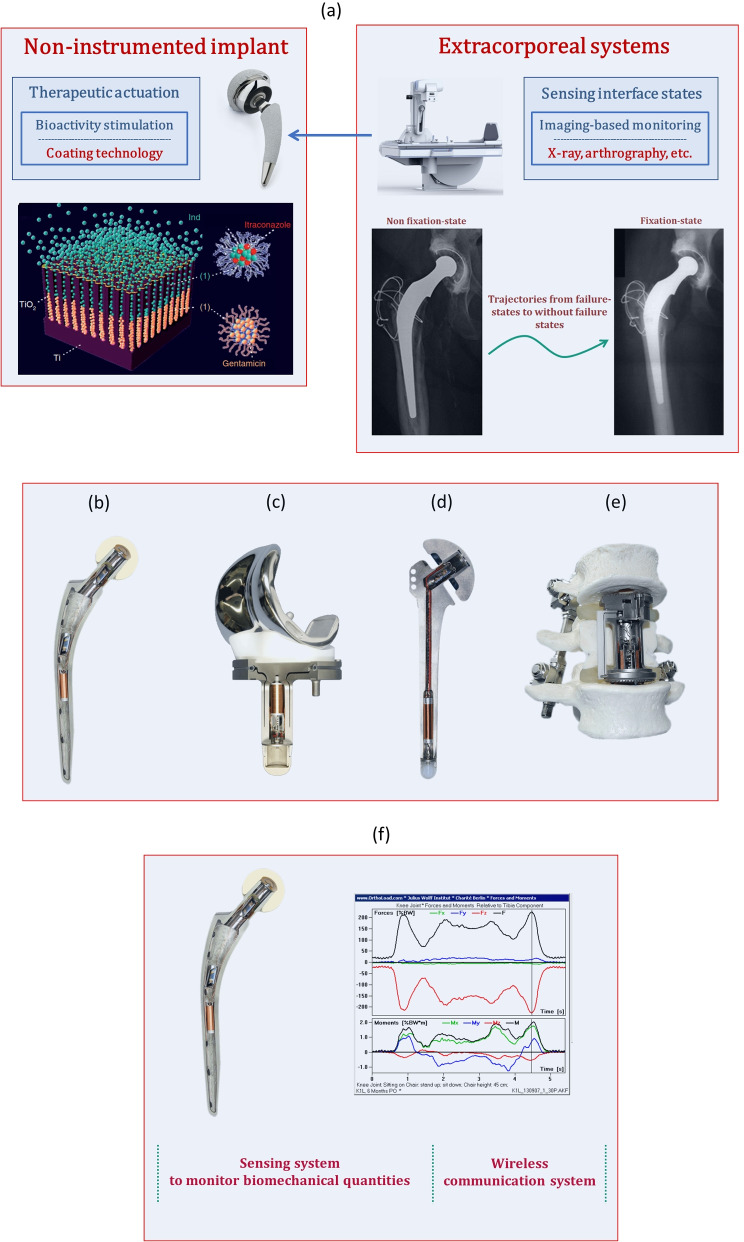 Bioelectronic multifunctional bone implants: recent trends.