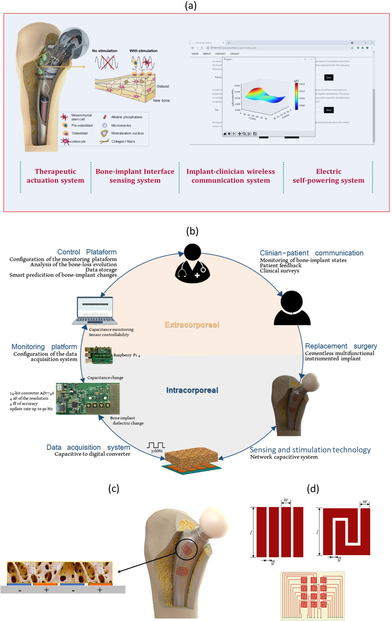 Bioelectronic multifunctional bone implants: recent trends.