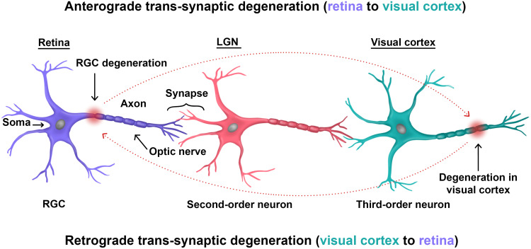 Eye Movement Abnormalities in Glaucoma Patients: A Review.