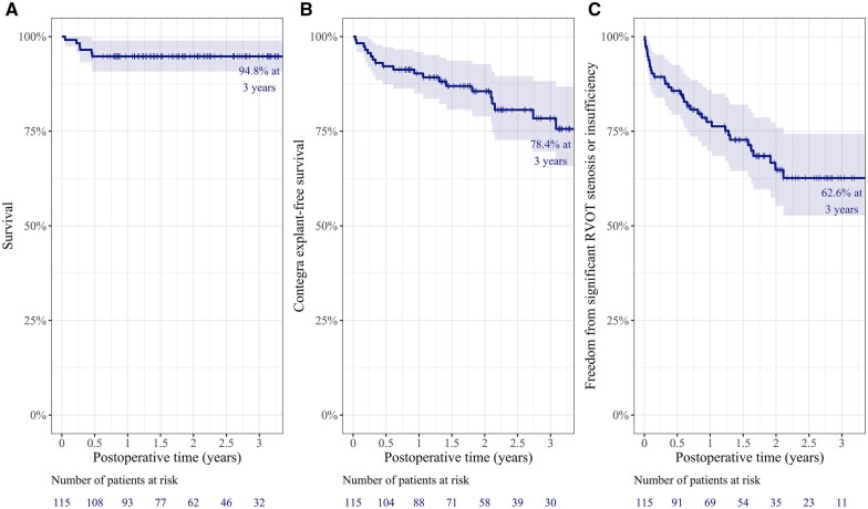 Risk factors for early adverse outcomes after bovine jugular vein conduit implantation: influence of oversized conduit on the outcomes.