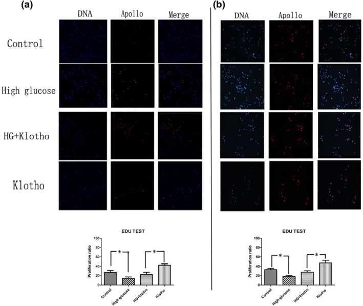 The effect of Klotho protein complexed with nanomaterials on bone mesenchymal stem cell performance in the treatment of diabetic ischaemic ulcer