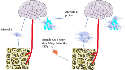 Advances in the study of the relationship between Alzheimer's disease and the gastrointestinal microbiome