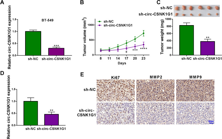 Circ-CSNK1G1 promotes cell proliferation, migration, invasion and glycolysis metabolism during triple-negative breast cancer progression by modulating the miR-28-5p/LDHA pathway.