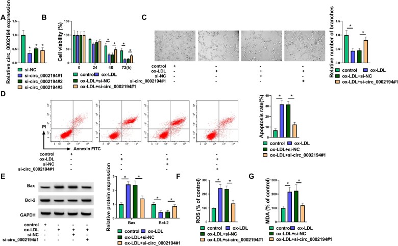 Knockdown of circ_0002194 protects against oxidized low-density lipoprotein-induced cell damage via the regulation of the miR-637/PACS2 axis in human vascular endothelial cells.