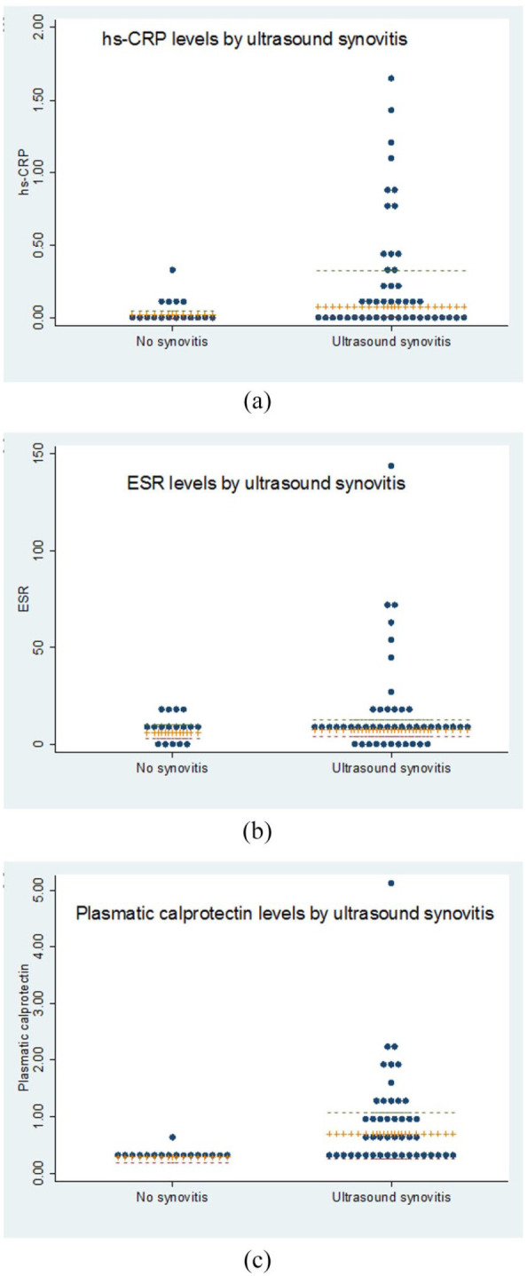 Plasma calprotectin as a biomarker of ultrasound synovitis in rheumatoid arthritis patients receiving IL-6 antagonists or JAK inhibitors.