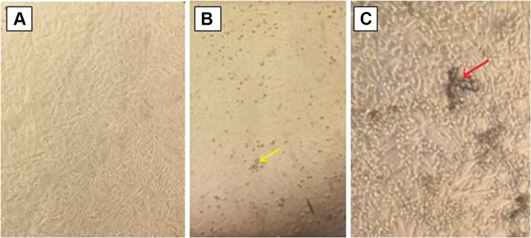 Isolation and Molecular Detection of Marek's Disease Virus from Outbreak Cases in Chicken in South Western Ethiopia.