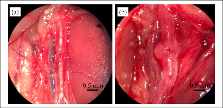 Microsurgical arterial anastomosis in young and adult rats: an evolutive and comparative study.