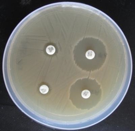 Pharmacokinetics of ceftriaxone-tazobactam (8:1) combination in healthy and <i>Escherichia coli</i> induced diarrhoeic birds.