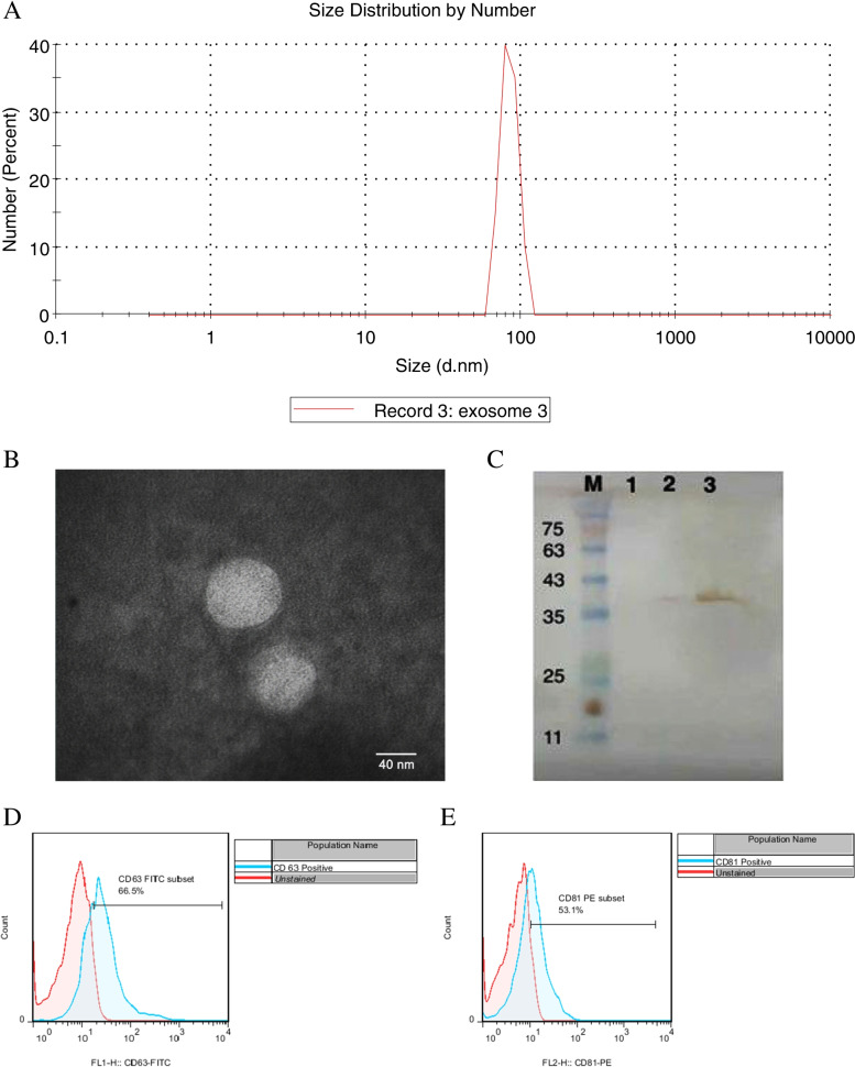 Mesenchymal stem cells- derived exosomes inhibit the expression of Aquaporin-5 and EGFR in HCT-116 human colorectal carcinoma cell line.