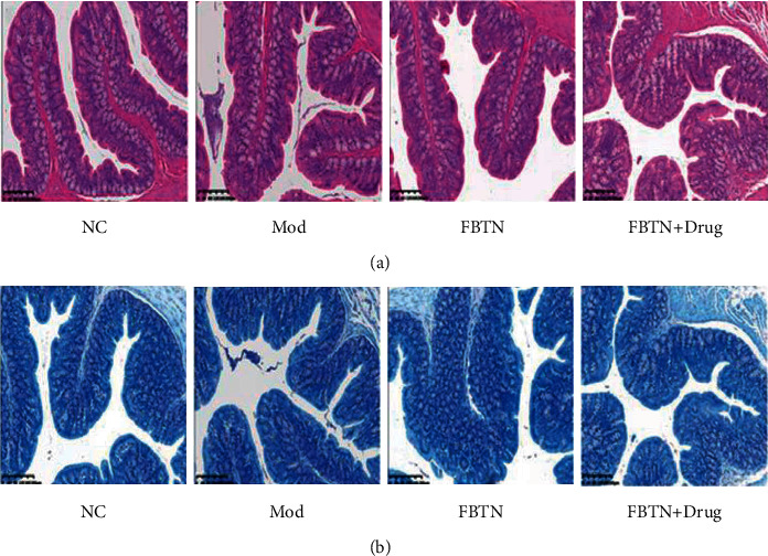 Abdominal Massage Improves the Symptoms of Irritable Bowel Syndrome by Regulating Mast Cells via the Trypase-PAR2-PKC<i>ε</i> Pathway in Rats.