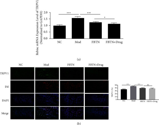 Abdominal Massage Improves the Symptoms of Irritable Bowel Syndrome by Regulating Mast Cells via the Trypase-PAR2-PKC<i>ε</i> Pathway in Rats.