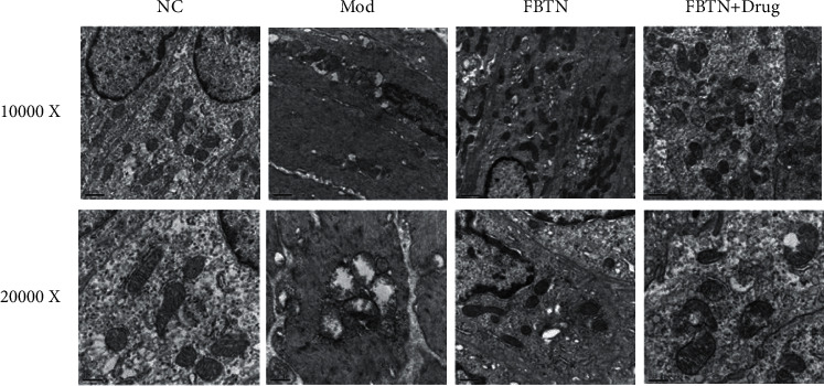 Abdominal Massage Improves the Symptoms of Irritable Bowel Syndrome by Regulating Mast Cells via the Trypase-PAR2-PKC<i>ε</i> Pathway in Rats.