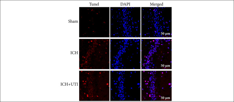 Ulinastatin alleviates early brain injury after intracerebral hemorrhage by inhibiting oxidative stress and neuroinflammation via ROS/MAPK/Nrf2 signaling pathway.