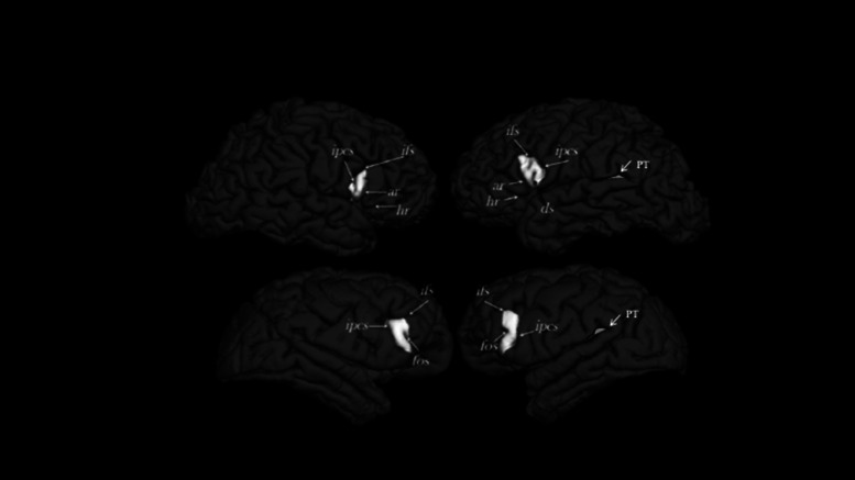 Neuroanatomical asymmetries in nonhuman primates in the homologs to Broca's and Wernicke's areas: a mini-review.