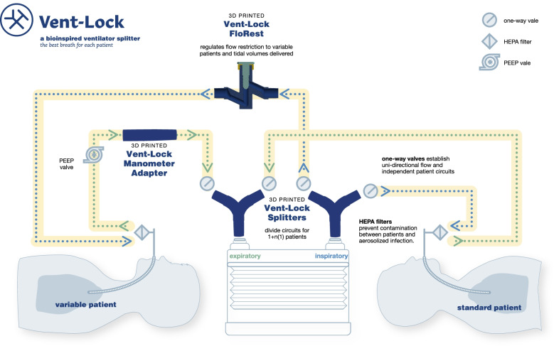 Translational design for limited resource settings as demonstrated by Vent-Lock, a 3D-printed ventilator multiplexer.