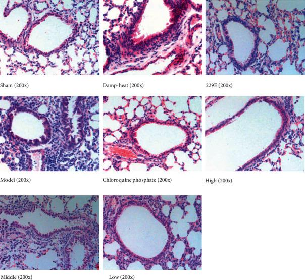 Xiang Qin Kang Gan Granules Treated the Human Coronavirus 229E Induced Pneumonia with Damp-Heat Syndrome in Mice.