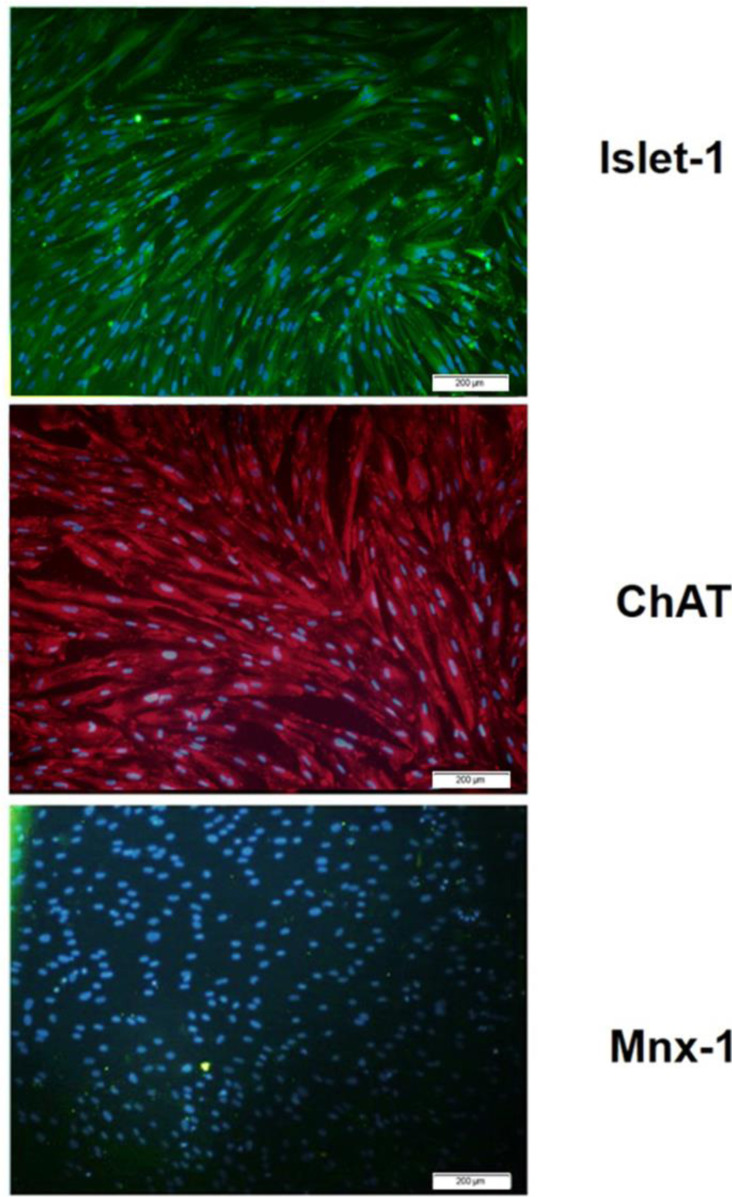 In Vitro Assessment of the Gene Expression of EZH-2 and P300 During Motor Neuron Differentiation of Human Umbilical Cord Blood Mesenchymal Stem Cells.