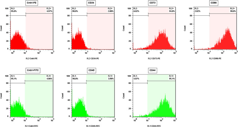 In Vitro Assessment of the Gene Expression of EZH-2 and P300 During Motor Neuron Differentiation of Human Umbilical Cord Blood Mesenchymal Stem Cells.