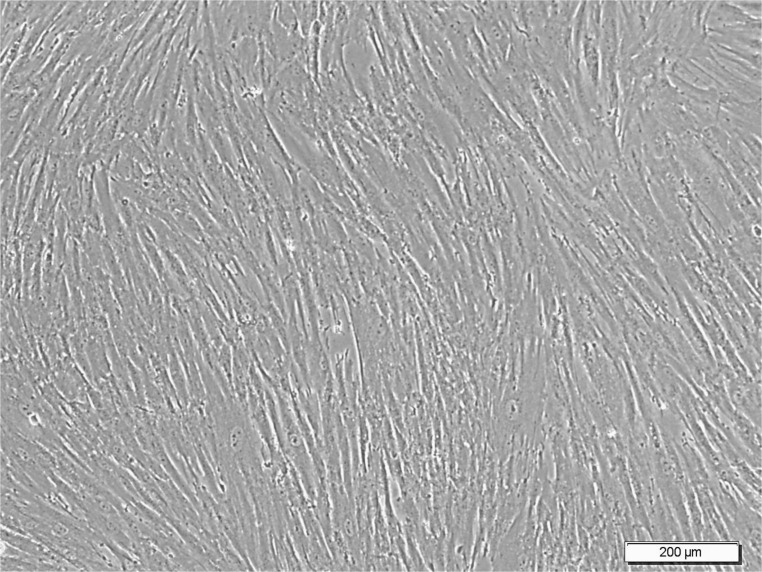 In Vitro Assessment of the Gene Expression of EZH-2 and P300 During Motor Neuron Differentiation of Human Umbilical Cord Blood Mesenchymal Stem Cells.