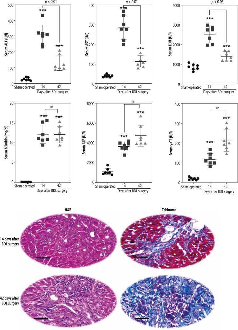 Cellular and mitochondrial taurine depletion in bile duct ligated rats: a justification for taurine supplementation in cholestasis/cirrhosis.