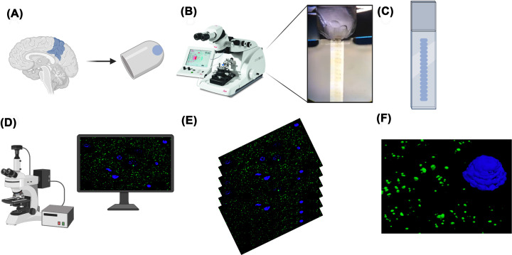 Array tomography: 15 years of synaptic analysis.