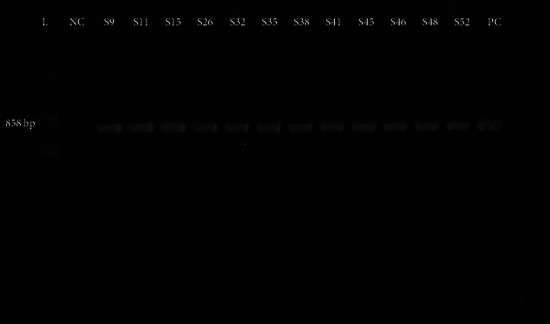 Investigating Antimicrobial Resistance and ESBL Producing Gene in <i>Klebsiella</i> Isolates among Neonates and Adolescents in Southern Bangladesh.