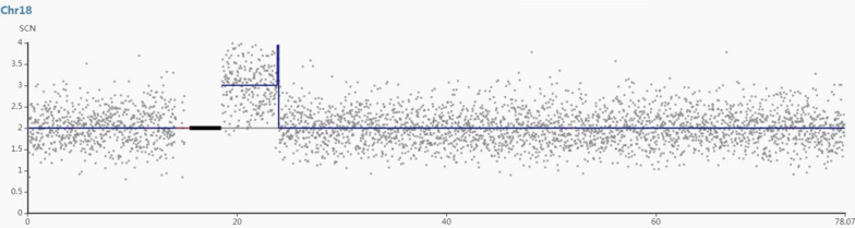 Prenatal diagnosis and genetic counseling of a paternally inherited microduplication 18q11.1 to 18q11.2 in a chinese family.