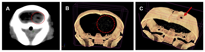 Antibody Delivery into the Brain by Radiosensitizer Nanoparticles for Targeted Glioblastoma Therapy.