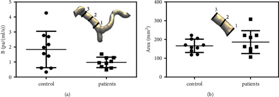 Flow Resistance Analysis of Clinically Significant Portal Hypertension in Patients with Liver Cirrhosis.