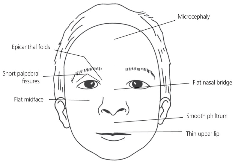 Prenatal maternal alcohol exposure: diagnosis and prevention of fetal alcohol syndrome.
