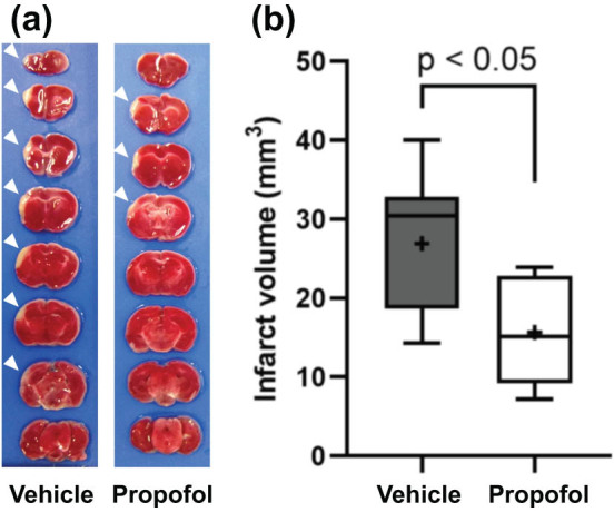 Propofol ameliorates ischemic brain injury by blocking TLR4 pathway in mice.