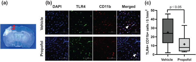 Propofol ameliorates ischemic brain injury by blocking TLR4 pathway in mice.