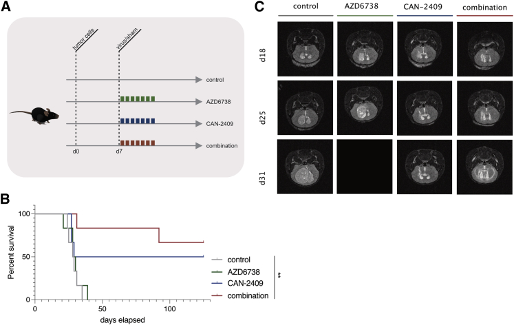 Perturbing DDR signaling enhances cytotoxic effects of local oncolytic virotherapy and modulates the immune environment in glioma.